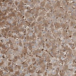 Serine protease 23 Antibody, Novus Biologicals 0.1mL; Unlabeled:Antibodies,