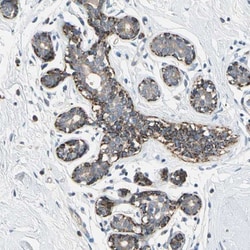 Serine/threonine-protein kinase NIM1 Antibody, Novus Biologicals 0.1mL;