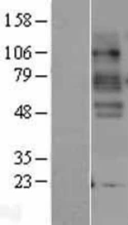 Novus Biologicals™ SLC6A4/5-HTTLPR/Serotonin transporter Overexpression Lysate