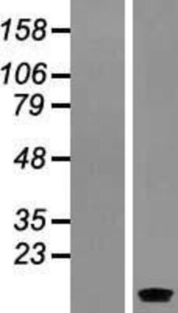 Novus Biologicals&trade;&nbsp;SERP1 Overexpression Lysate