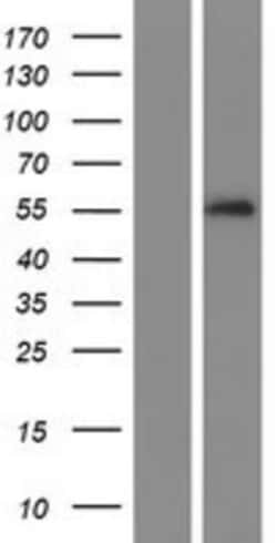 Novus Biologicals&trade;&nbsp;Serpin A10/ZPI Overexpression Lysate