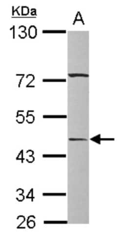 Serpin A12 Antibody, Novus Biologicals 0.1mL; Unlabeled:Antibodies, Polyclonal