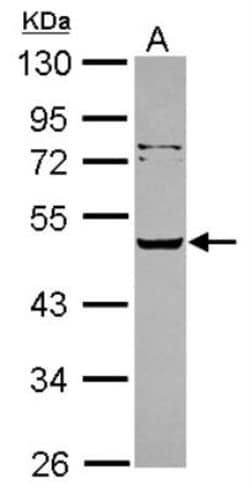 Serpin A12 Antibody, Novus Biologicals 0.1mL; Unlabeled:Antibodies, Polyclonal