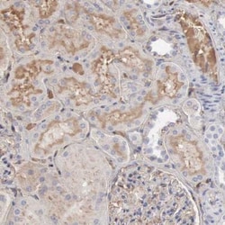 Serpin A1/alpha 1-Antitrypsin Antibody, Novus Biologicals:Antibodies:Primary