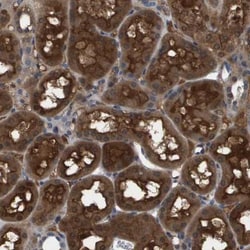 Serpin A6/Cortisol Binding Globulin Antibody, Novus Biologicals:Antibodies:Primary