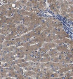 Serpin A6/Cortisol Binding Globulin Antibody, Novus Biologicals:Antibodies:Primary
