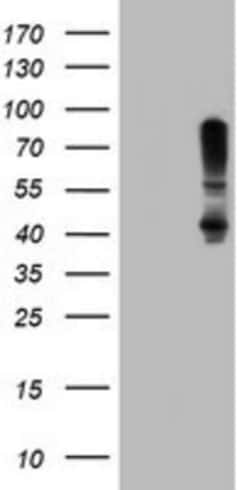 SERPINB1 Antibody (OTI3B4), Novus Biologicals 0.1mL; Unlabeled:Antibodies,