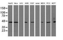 SERPINB1 Antibody (OTI3B4), Novus Biologicals 0.1mL; Unlabeled:Antibodies,