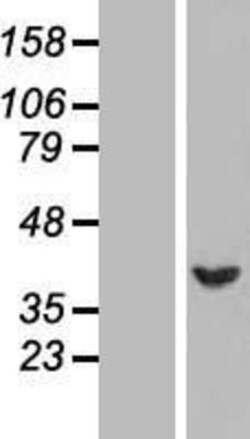 Novus Biologicals™ SERPINB1 Overexpression Lysate