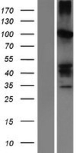 Novus Biologicals&trade;&nbsp;SERPINB11 Overexpression Lysate