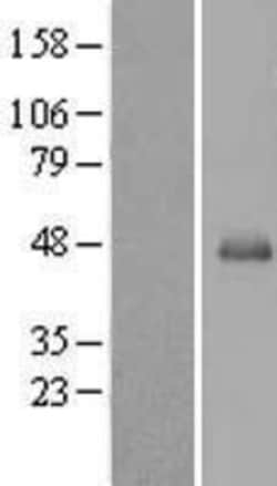 Novus Biologicals&trade;&nbsp;SERPINB13 Overexpression Lysate