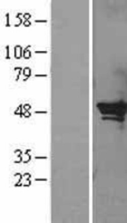 Novus Biologicals™ SerpinB2 Overexpression Lysate