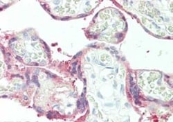 SerpinB2 Antibody, Novus Biologicals 0.1mg; Unlabeled:Antibodies, Polyclonal