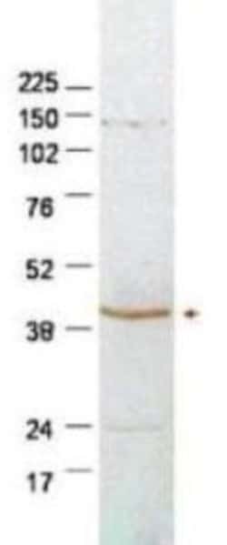 SerpinB2 Antibody, Novus Biologicals 0.1mg; Unlabeled:Antibodies, Polyclonal
