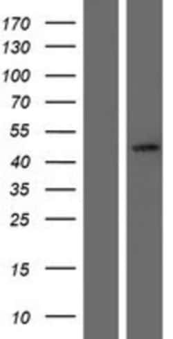 Novus Biologicals&trade;&nbsp;SerpinB7 Overexpression Lysate