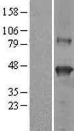 Novus Biologicals™ SerpinB9 Overexpression Lysate