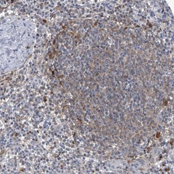 SerpinB9 Antibody, Novus Biologicals:Antibodies:Primary Antibodies