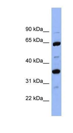 Serpin C1/Antithrombin-III Antibody, Novus Biologicals 20&mu;L; Unlabeled:Antibodies,