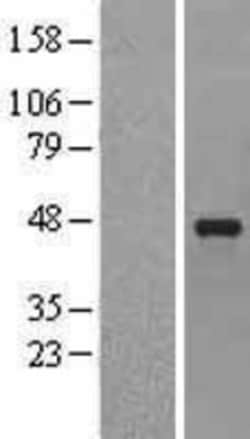 Novus Biologicals&trade;&nbsp;Serpin E2/PN1 Overexpression Lysate