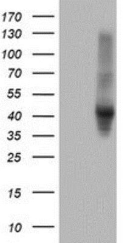 Serpin E2/PN1 Antibody (OTI2C9), Novus Biologicals 0.1mL; Unlabeled:Antibodies,