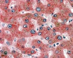 Serpin F2/alpha 2-Antiplasmin Antibody, Novus Biologicals 0.1mg; Unlabeled:Antibodies,