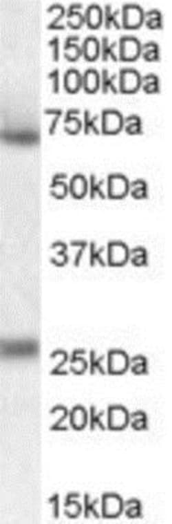 Serpin F2/alpha 2-Antiplasmin Antibody, Novus Biologicals 0.1mg; Unlabeled:Antibodies,