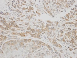 Serpin G1/C1 Inhibitor Antibody, Novus Biologicals 0.1mg; Unlabeled:Antibodies,