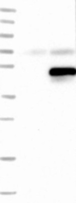 SERTAD2 Antibody, Novus Biologicals 0.1mL; Unlabeled:Antibodies, Polyclonal