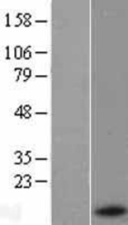 Novus Biologicals&trade;&nbsp;Serum Amyloid A1 Overexpression Lysate