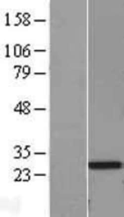 Novus Biologicals&trade;&nbsp;Pentraxin 2/SAP Overexpression Lysate