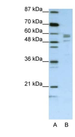 Seryl tRNA synthetase Antibody, Novus Biologicals 100&mu;L; Unlabeled:Antibodies,