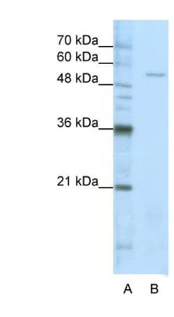 Seryl tRNA synthetase Antibody, Novus Biologicals 100&mu;L; Unlabeled:Antibodies,