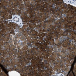 Seryl tRNA synthetase Antibody, Novus Biologicals 0.1mL; Unlabeled:Antibodies,