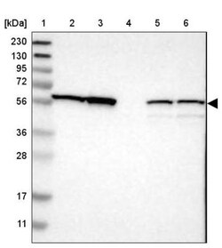 Seryl tRNA synthetase Antibody, Novus Biologicals 0.1mL; Unlabeled:Antibodies,