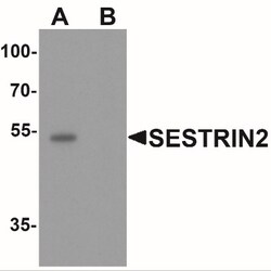 SESN2 Antibody - BSA Free, Novus Biologicals 0.025 mg, Unlabeled:Antibodies,