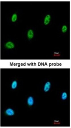 SESN3 Antibody, Novus Biologicals 0.1mg; Unlabeled:Antibodies, Polyclonal