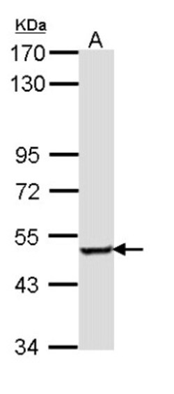 SESN3 Antibody, Novus Biologicals 0.1mg; Unlabeled:Antibodies, Polyclonal