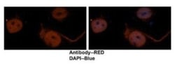 SET Antibody, Novus Biologicals 20&mu;L; Unlabeled:Antibodies, Polyclonal
