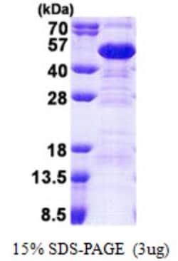 Novus Biologicals&trade;&nbsp;Recombinant Human SET His Protein