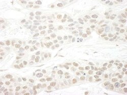 SET1B Antibody, Novus Biologicals 0.1mg; Unlabeled:Antibodies, Polyclonal