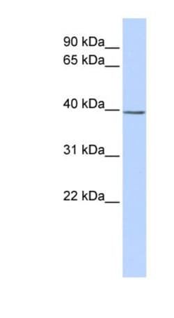 SETD3 Antibody, Novus Biologicals:Antibodies:Primary Antibodies