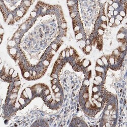 SETD3 Antibody, Novus Biologicals:Antibodies:Primary Antibodies