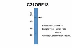 SETD4 Antibody, Novus Biologicals 20&mu;L; Unlabeled:Antibodies, Polyclonal