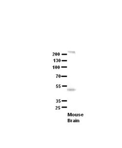SETD4 Antibody, Novus Biologicals 100&mu;L; Unlabeled:Antibodies, Polyclonal