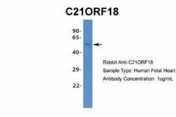 SETD4 Antibody, Novus Biologicals 20&mu;L; Unlabeled:Antibodies, Polyclonal