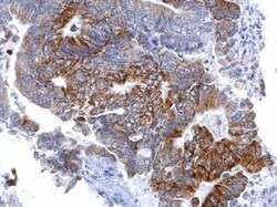 SETD6 Antibody (688), Novus Biologicals 0.1mL; Unlabeled:Antibodies, Monoclonal