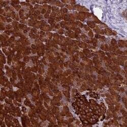 SETD6 Antibody, Novus Biologicals 25 &mu;L, Unlabeled:Antibodies, Polyclonal