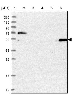 SETD6 Antibody, Novus Biologicals 25 &mu;L, Unlabeled:Antibodies, Polyclonal