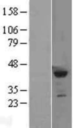 Novus Biologicals&trade;&nbsp;SETD8 Overexpression Lysate
