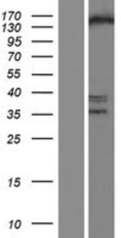 Novus Biologicals&trade;&nbsp;SETDB1 Overexpression Lysate